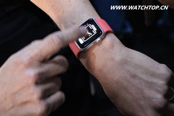 AppleWatch用戶“就醫(yī)指南”公布 戴表別戴成奇葩 就醫(yī)指南 applewatch 熱點動態(tài)  第2張